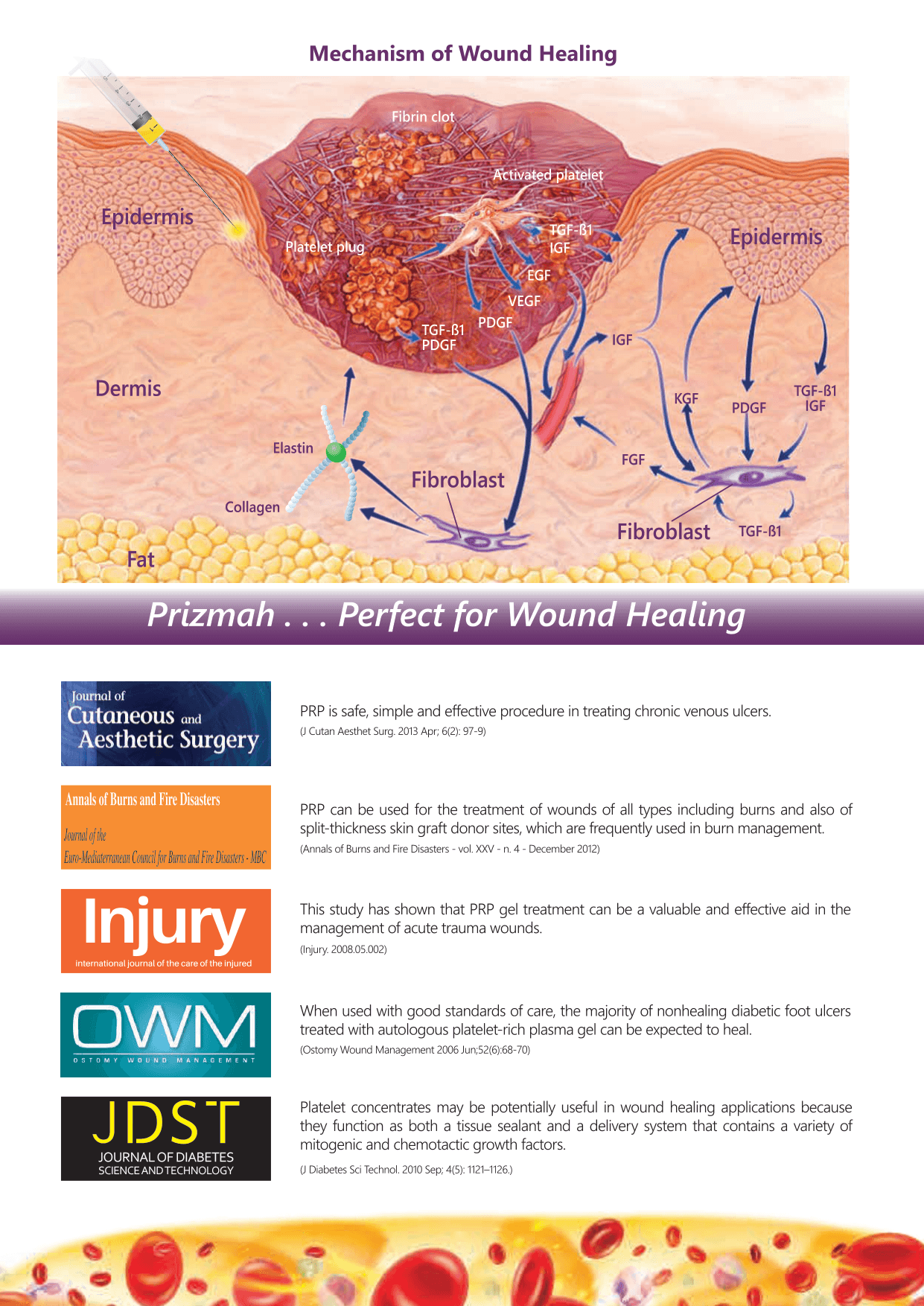 Mechanism of wound healing with Prizmah