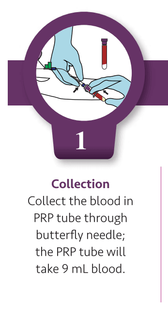 Step 1: Collection