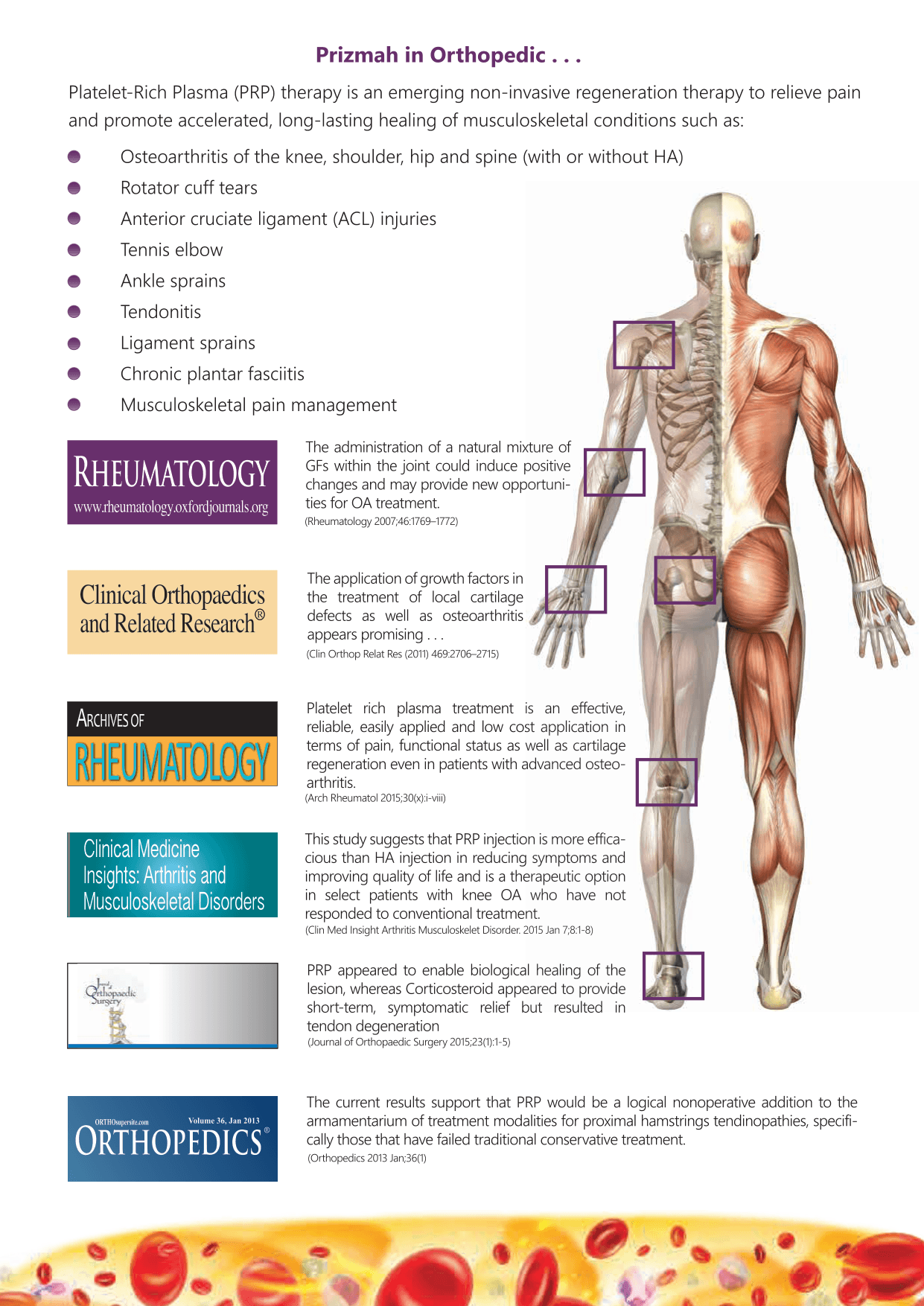 Musculoskeletal treatment sites for Prizmah orthopedic PRP