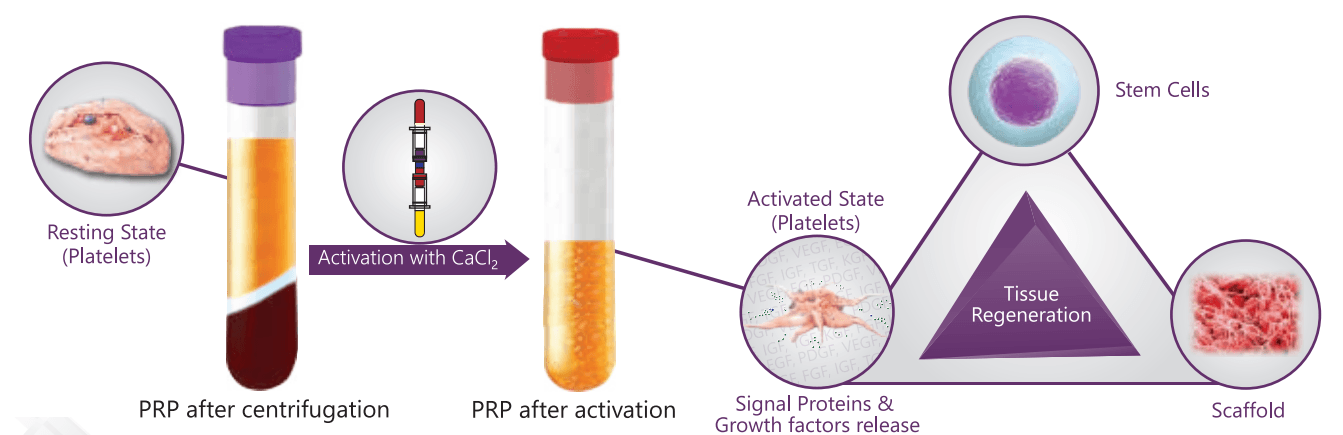Schematic diagram of activated PRP with mode of action